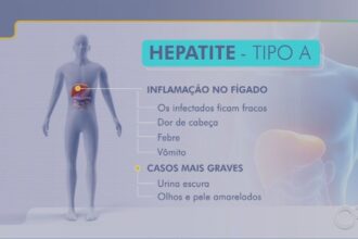 casos-de-hepatite-a-aumentam-54,5%-em-2024-no-brasil,-diz-ministerio-da-saude