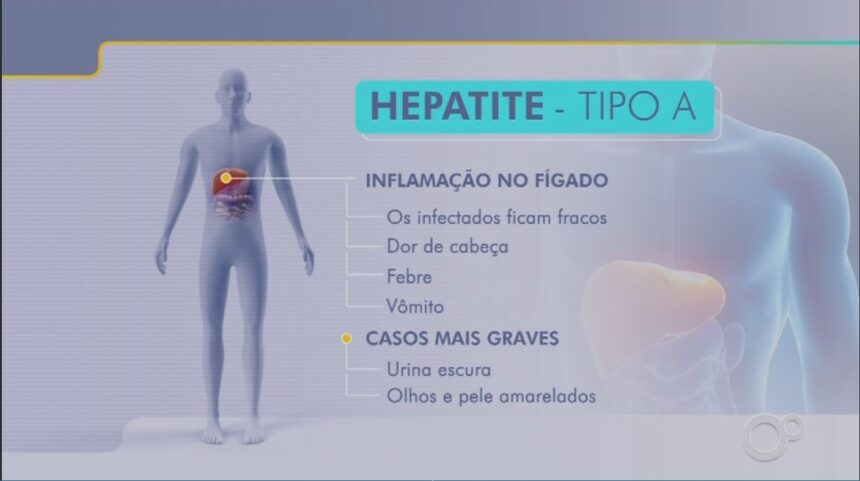 casos-de-hepatite-a-aumentam-54,5%-em-2024-no-brasil,-diz-ministerio-da-saude