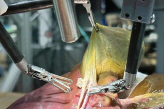 robo-realiza-primeira-cirurgia-realista-sem-auxilio-humano