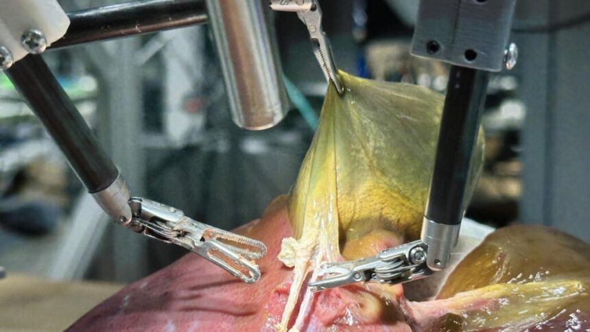 robo-realiza-primeira-cirurgia-realista-sem-auxilio-humano
