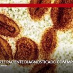 mpox-deixa-de-ser-emergencia-de-saude-internacional,-anuncia-oms