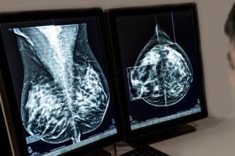 pesquisa-brasileira-descobre-por-que-alguns-tipos-de-cancer-de-mama-nao-respondem-a-tratamentos
