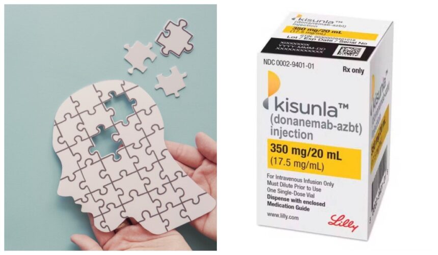 alzheimer:-remedio-aprovado-pela-anvisa-tem-custo-alto-e-eficacia-limitada