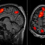 cientistas-conseguem-avanco-inedito-em-tratamento-de-doenca-degenerativa-com-terapia-genetica
