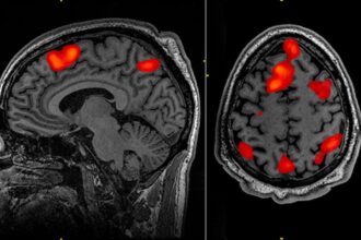 cientistas-conseguem-avanco-inedito-em-tratamento-de-doenca-degenerativa-com-terapia-genetica