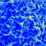 cancer-transforma-ambiente-acido-em-combustivel-para-crescer,-diz-estudo