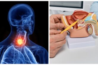bloqueio-de-hormonio-da-tireoide-impede-crescimento-de-tumor-de-prostata,-aponta-estudo