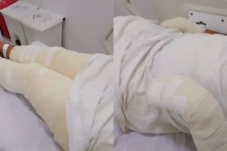 homem-e-preso-apos-tentar-matar-irmao-queimado-enquanto-ele-dormia-no-ceara