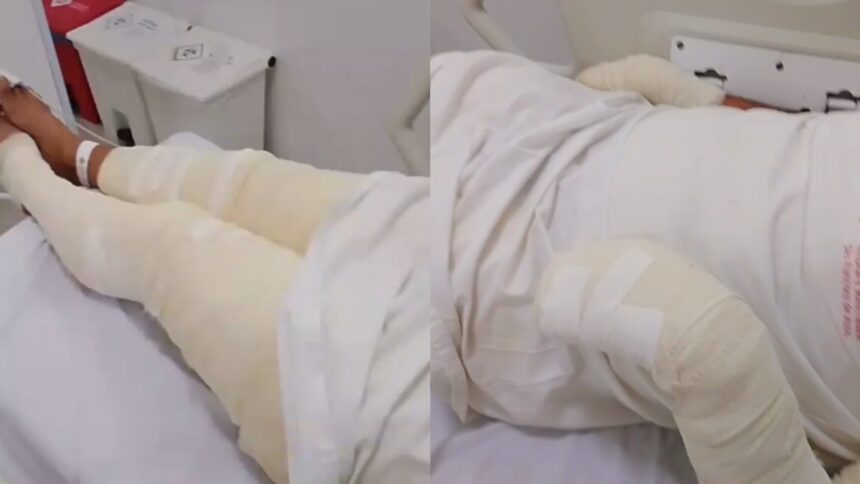 homem-e-preso-apos-tentar-matar-irmao-queimado-enquanto-ele-dormia-no-ceara