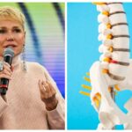 cirurgia-da-xuxa-na-coluna:-entenda-o-que-e-a-estenose-de-canal-e-como-prevenir