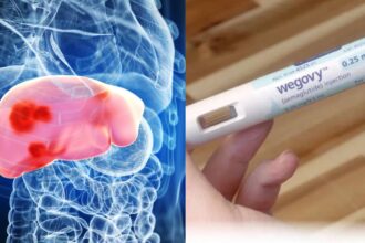anvisa-aprova-semaglutida-para-tratar-gordura-no-figado-com-inflamacao