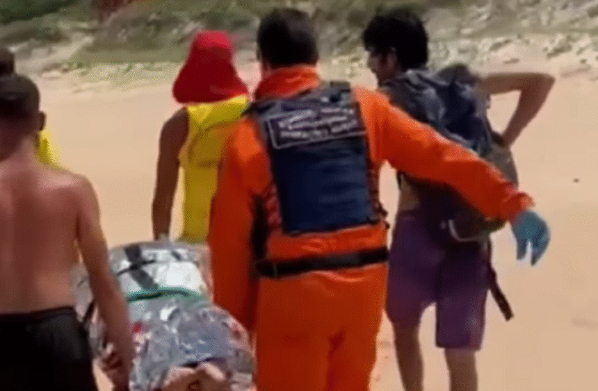 mulher-sofre-ataque-de-capivara-durante-mergulho-e-fica-sem-parte-da-nadega