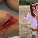 turista-e-mordida-por-tubarao-durante-mergulho-em-fernando-de-noronha