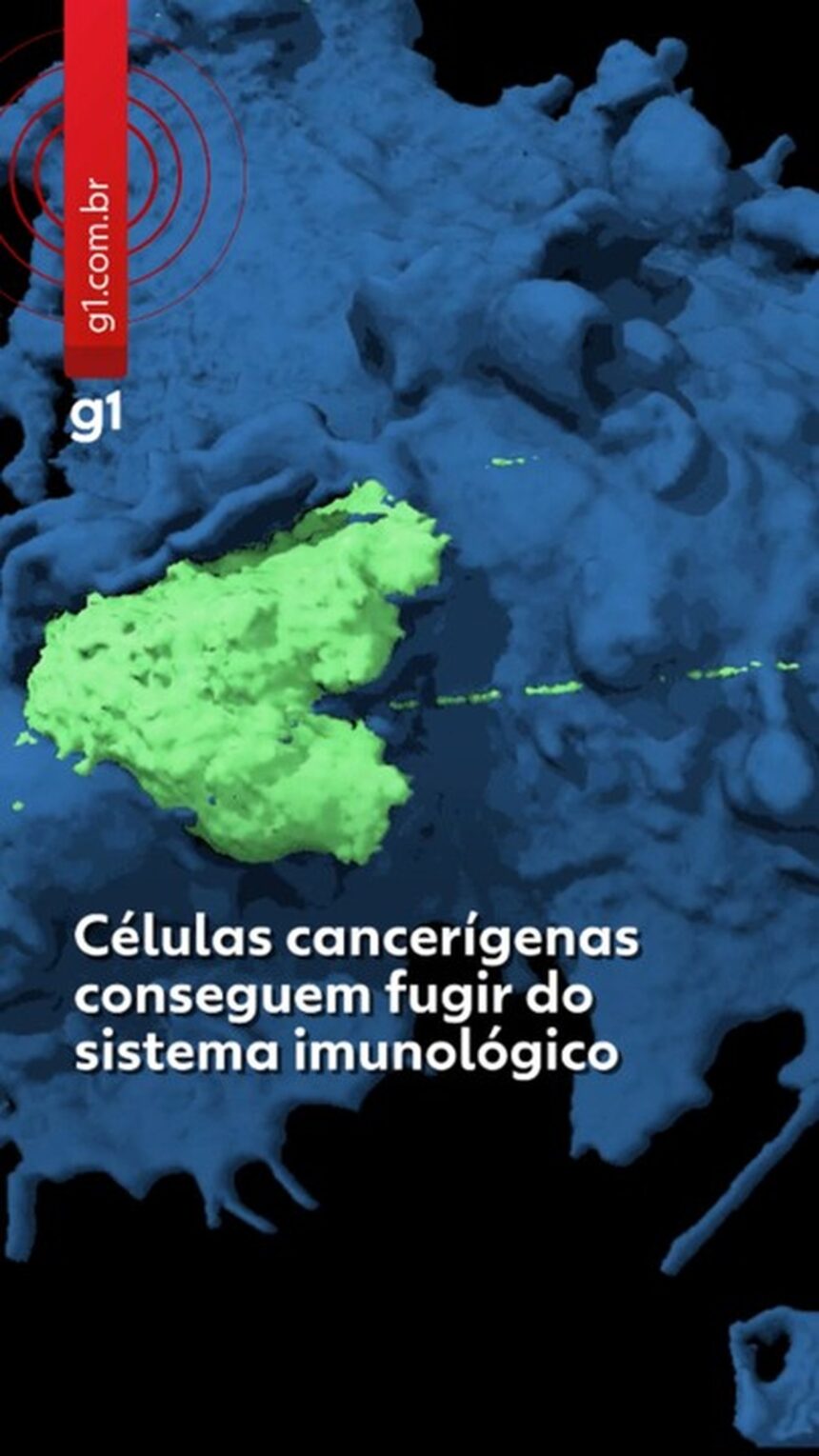 video-mostra-celulas-de-cancer-escapando-do-sistema-imunologico-e-explica-como-doenca-avanca