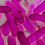 sindrome-rara-faz-pacientes-“ficarem-bebados”-sem-consumir-alcool