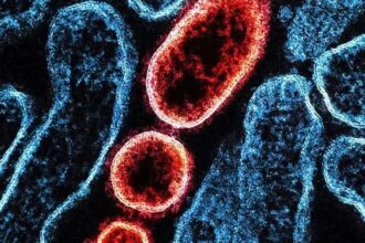 ha-risco-de-um-surto-maior-do-nipah,-virus-sem-vacina-e-com-taxa-de-mortalidade-de-ate-75%?