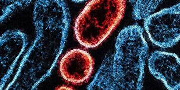 ha-risco-de-um-surto-maior-do-nipah,-virus-sem-vacina-e-com-taxa-de-mortalidade-de-ate-75%?