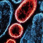 nipah:-virus-volta-a-preocupar-saude-global-apos-casos-na-india,-mas-sem-cenario-de-novo-surto