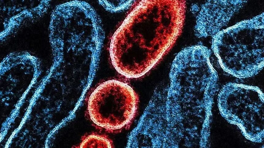 nipah:-virus-volta-a-preocupar-saude-global-apos-casos-na-india,-mas-sem-cenario-de-novo-surto