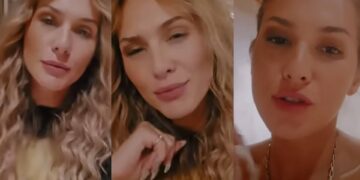 neuralgia-do-trigemeo,-‘a-pior-dor-do-mundo’:-entenda-a-condicao-da-apresentadora-livia-andrade