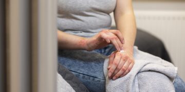 sus-passa-a-usar-antibiotico-para-prevenir-sifilis-e-clamidia-apos-exposicao-a-risco